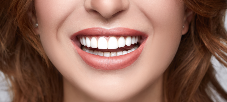 5 Options For Tooth Restoration