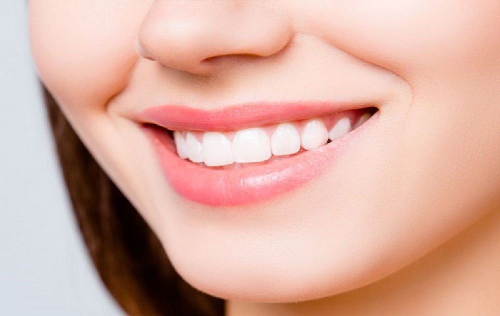 teeth-whitening-issue-and-options-to-consider.